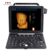 Medical Ultrasound Instruments Cardiac Echo 4D Portable Color Doppler Ultrasound machine